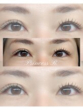 プリンセスアール(Princess R)/フラットラッシュ１００本