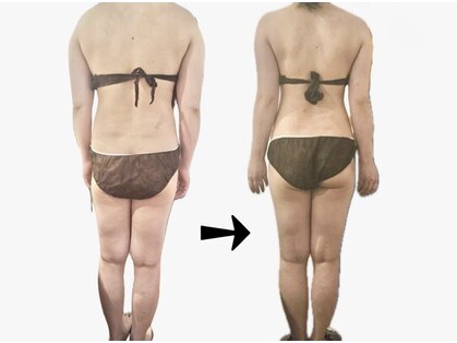 トニートニー(Tony Tony)の写真