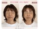 リフェイス(RE:FACE)の写真