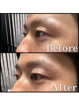 眉毛男子 新宿店/眉毛の施術例