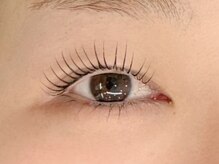 エマ(emma)/シンプリフィラッシュリフト