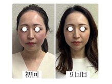 ラボーテヴェリテ(La Beaute Verite)/【お客様施術例】