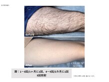 ビープランニング(B-PLANNING.)/【メンズ脱毛で印象が変わる】