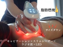 クレンズ(CLeanse)の雰囲気（キャビテーション.ラジオ波.LED複合機で施術時間が短いのが特徴）