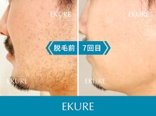エクレ 柏店(EKURE)の雰囲気（脱毛専門店だから結果にこだわり満足いただける施術を行います！）