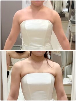 トレゾール(tresor)/★ブライダル★赤坂痩身エステ