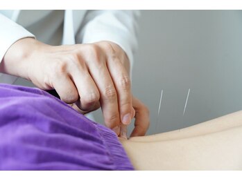 はるちか朱環院の写真/疲れを科学と東洋医学で解明！名大卒の鍼灸師が根本ケアをサポート♪