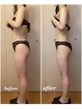 アンフィニ(infini)/短期集中全身コース5回（2ヶ月）