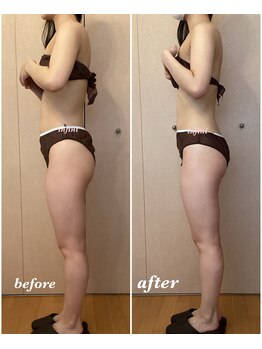 アンフィニ(infini)/短期集中全身コース5回(2ヶ月)