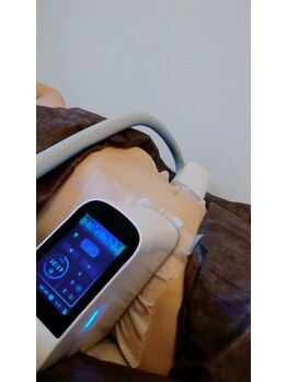 ルアナ(Luana)/本日はお腹両サイドの脂肪冷却♪