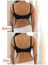 シエスタ(SIESTA)/Before→After はみ肉スッキリ！