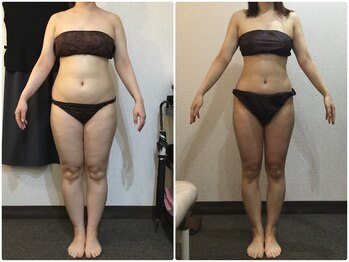 ウェリナ平和堂長久手院/小顔矯正/骨盤矯正/痩身/整体