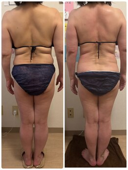 ココ(coco)/大人気!ベテランの本格痩身♪