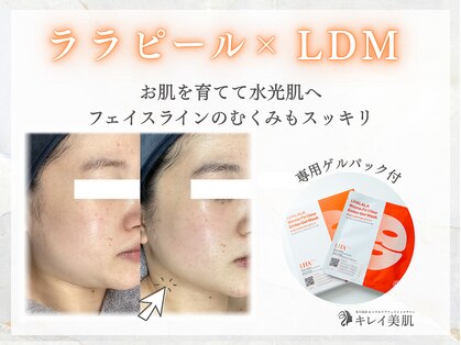 キレイ美肌 北心斎橋店の写真