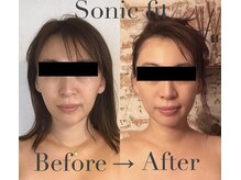 エヌ アンド エイチ ソニックフィット(N&H sonicfit)の雰囲気（ソニックフィットはくすみも、お肌の調子も良くなります！！）
