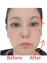 レポリア(Reporia)/EMSヘッドブラシBeforeAfter