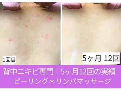 おうちサロン ミキの写真