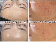 ナチュール(nature)