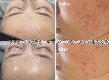 ナチュール(nature)