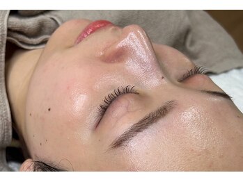 シェアリー(sharely..)の写真/話題の水光肌waxでベールを貼ったような憧れ美肌に☆よもぎ蒸しとあわせて効果UP!水分たっぷりのお肌へ♪