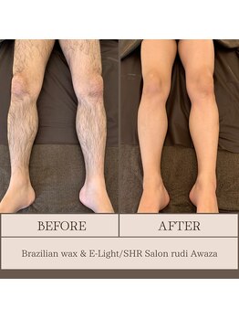 ルディ 阿波座店(rudi)/足ALL ワックス&光脱毛