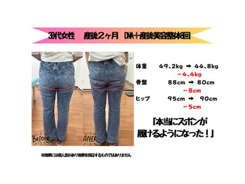 恵整骨院/30代ママさん DNA・痩身/骨盤