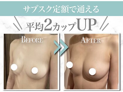 美人バスト 小倉店の写真