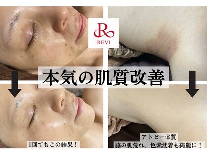 サロンデュヒャーク 志木駅前店(salon du ひゃーく)の写真