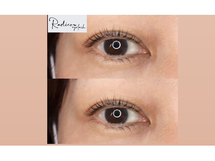 ラディーチェ アイラッシュ(Radice eyelash)の写真