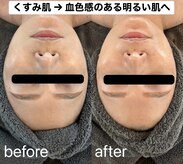 四季ビューティー(四季beauty)