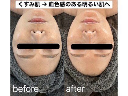 四季ビューティー(四季beauty)の写真