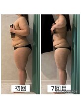 エクラ(Eclat)/Eclatの痩身★BeforeAfter1