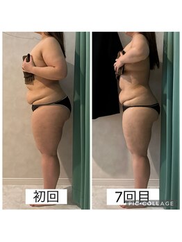 エクラ(Eclat)/Eclatの痩身★BeforeAfter1