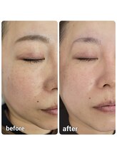 ヴェリー(Very)/エアバリ