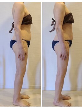 サロンサンティ/小尻・美脚・お腹周りケア