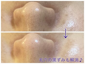 テールボーテ(Terre beaute)/毛穴の黒ずみ解消☆
