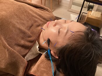 ハリファ鍼灸院 横浜関内院(HariFa鍼灸院)/美容鍼