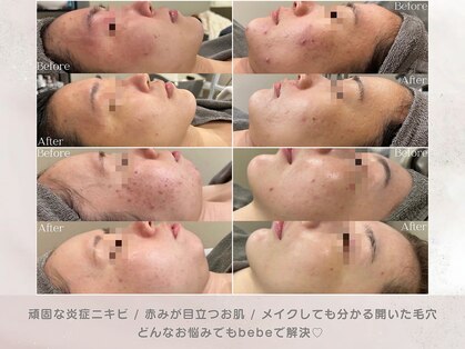 ベベ 表参道(bebe)の写真