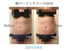 リープル(Leapl)/【腸もみ】腸もみ後の変化写真