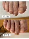 爪ケア症例
