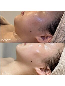 サロン ド ブラン アオヤマ(Salon de BLANC AOYAMA)/