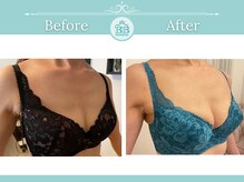 美人バスト 柏店/【バストアップ・育乳】症例