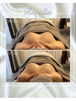 レヴェリア(Revellia)/ふっくらバスト