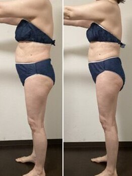 エステティックサロン ローブ(ESTHETIC SALON LAUB)の写真/新生活応援キャンペーン♪3月限定/人気No.1痩身コースが最安値!⇒《オーダーメイドダイエット120分¥6,480》