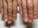 本気の自爪育成