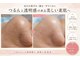 エルナ(ELUNA)の写真