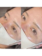 ルーム(ROOM)/立ち上げ♪自まつ毛最大限に！