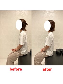 ナオル整体 福岡香椎院(NAORU整体)/20代女性施術事例【猫背】