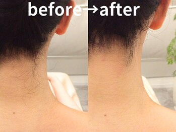 ももとゆでたまご/襟足シェービングbefore→after