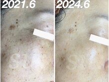 スウ(su:)/とにかく手触りがふわふわに！